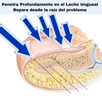 Fungal Nail NightRepair™ – Repara y Fortalece Tus Uñas Mientras Duermes