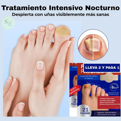 Fungal Nail NightRepair™ – Repara y Fortalece Tus Uñas Mientras Duermes